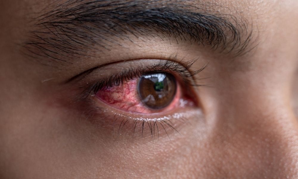 ¿Cómo puede el Coronaviros afectar a sus ojos?